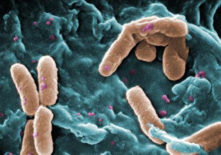Pseudomonas-aeruginosa.jpg